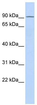 WB Suggested Anti-TIPARP Antibody Titration: 0.2-1 ug/ml; ELISA Titer: 1:312500; Positive Control: Human heart