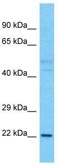 Host: Rabbit; Target Name: TLCD1; Sample Tissue: Fetal Lung lysates; Antibody Dilution: 1.0ug/ml
