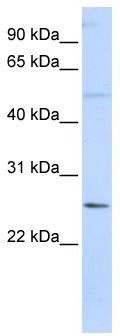 WB Suggested Anti-FTHL17 Antibody Titration: 0.2-1 ug/ml; ELISA Titer: 1: 312500; Positive Control: 721_B cell lysate