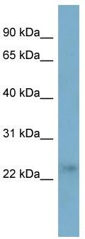 WB Suggested Anti-FTHL17 Antibody Titration: 0.2-1 ug/ml; ELISA Titer: 1: 312500; Positive Control: PANC1 cell lysate