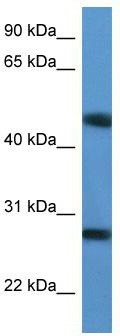 WB Suggested Anti-TM2D2 Antibody Titration: 0.2-1 ug/ml; ELISA Titer: 1:312500; Positive Control: Jurkat cell lysate