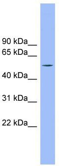 WB Suggested Anti-TMCO6 Antibody Titration: 0.2-1 ug/ml; Positive Control: Human Placenta