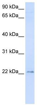 WB Suggested Anti-TMEM9 Antibody Titration: 0.2-1 ug/ml; ELISA Titer: 1: 12500; Positive Control: Human brain