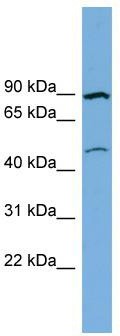 WB Suggested Anti-TMEM48 Antibody Titration: 0.2-1 ug/ml; Positive Control: THP-1 cell lysate