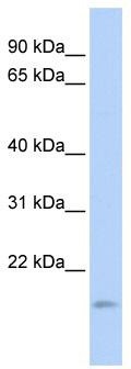 WB Suggested Anti-TNFAIP8L1 Antibody Titration: 0.2-1 ug/ml; ELISA Titer: 1: 62500; Positive Control: HepG2 cell lysate