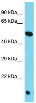 Host: Rabbit; Target Name: TOR4A; Sample Tissue: HepG2 Whole Cell lysates; Antibody Dilution: 1.0ug/mlTOR4A is supported by BioGPS gene expression data to be expressed in HepG2