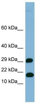 WB Suggested Anti-TRAPPC2L Antibody Titration: 0.2-1 ug/ml; ELISA Titer: 1:1562500; Positive Control: Human heart