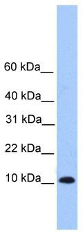 WB Suggested Anti-TRAPPC6B Antibody Titration: 0.2-1 ug/ml; Positive Control: Hela cell lysate