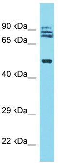 Host: Rabbit; Target Name: TRIM64; Sample Tissue: Fetal Lung lysates; Antibody Dilution: 1.0ug/ml