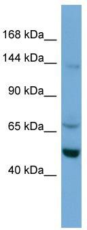 WB Suggested Anti-TRIM66 Antibody Titration: 0.2-1 ug/ml; ELISA Titer: 1: 62500; Positive Control: A549 cell lysate