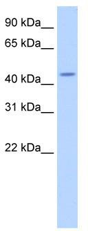 WB Suggested Anti-TRNT1 Antibody Titration: 2.5 ug/ml; ELISA Titer: 1: 62500; Positive Control: Human brain