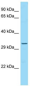 Host: Rabbit; Target Name: TRO; Sample Tissue: HT1080 Whole cell lysates; Antibody Dilution: 1.0 ug/ml
