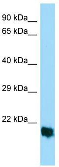 Host: Rabbit; Target Name: MPLKIP; Sample Tissue: HepG2 Whole Cell lysates; Antibody Dilution: 1.0 ug/ml