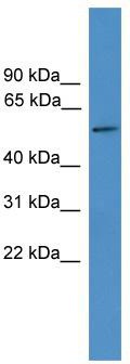WB Suggested Anti-TTYH3 Antibody Titration: 0.2-1 ug/ml; ELISA Titer: 1: 312500; Positive Control: Human kidney