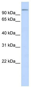 WB Suggested Anti-TXNDC16 Antibody Titration: 0.2-1 ug/ml; ELISA Titer: 1: 312500; Positive Control: Human brain