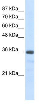 WB Suggested Anti-U1SNRNPBP Antibody Titration: 2.5 ug/ml; Positive Control: Jurkat cell lysate
