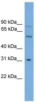 WB Suggested Anti-UGT1A5 Antibody Titration: 0.2-1 ug/ml; Positive Control: HT1080 cell lysate