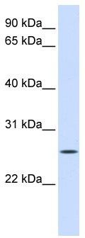 WB Suggested Anti-UNC50 Antibody Titration: 0.2-1 ug/ml; ELISA Titer: 1: 62500; Positive Control: Human Liver