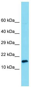 Host: Rabbit; Target Name: MNF1; Sample Tissue: 293T Whole Cell lysates; Antibody Dilution: 1.0 ug/ml.