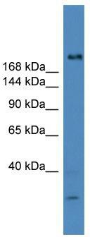 WB Suggested Anti-USP9Y Antibody Titration: 0.2-1 ug/ml; ELISA Titer: 1:1562500; Positive Control: Human Muscle