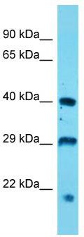 Host: Rabbit; Target Name: Usp12; Sample Tissue: Mouse Stomach lysates; Antibody Dilution: 1.0 ug/ml