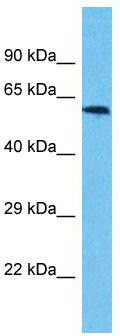Host: Rabbit; Target Name: USP17L3; Sample Tissue: Jurkat Whole Cell lysates; Antibody Dilution: 1.0ug/ml
