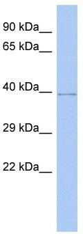 WB Suggested Anti-WDR53 Antibody Titration: 0.2-1 ug/ml; ELISA Titer: 1:1562500; Positive Control: Human brain