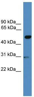 WB Suggested Anti-GAL3ST3 Antibody Titration: 0.2-1 ug/ml; ELISA Titer: 1: 1562500; Positive Control: MCF7 cell lysate