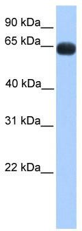 WB Suggested Anti-ZNF100 Antibody Titration: 0.2-1 ug/ml; Positive Control: Human Muscle