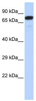 WB Suggested Anti-ZNF221 Antibody Titration: 0.2-1 ug/ml; ELISA Titer: 1:312500; Positive Control: Hela cell lysate