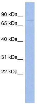 WB Suggested Anti-ZNF233 Antibody Titration: 0.2-1 ug/ml; ELISA Titer: 1:12500; Positive Control: Human Thymus