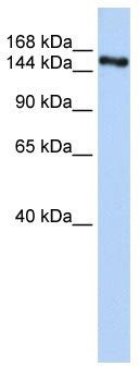 WB Suggested Anti-ZNF236 Antibody Titration: 0.2-1 ug/ml; ELISA Titer: 1: 312500; Positive Control: Human brain