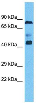 Host: Rabbit; Target Name: ZNF362; Sample Tissue: Ovary Tumor lysates; Antibody Dilution: 1.0 ug/ml