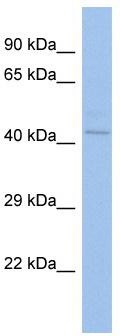 Host: Rabbit; Target Name: ZNF362; Sample Tissue: OVCAR-3 Whole cell lysates; Antibody Dilution: 1.0 ug/ml ZNF362 is supported by BioGPS gene expression data to be expressed in OVCAR3