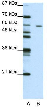 WB Suggested Anti-ZNF382 Antibody Titration: 1.25 ug/ml; ELISA Titer: 1: 1562500; Positive Control: Jurkat cell lysate
