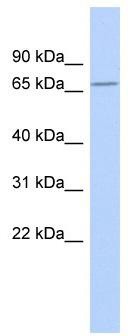 WB Suggested Anti-ZNF404 Antibody Titration: 0.2-1 ug/ml; ELISA Titer: 1:62500; Positive Control: MCF7 cell lysate
