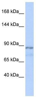 WB Suggested Anti-ZFAT1 Antibody Titration: 0.2-1 ug/ml; ELISA Titer: 1: 312500; Positive Control: Human Muscle