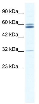 WB Suggested Anti-ZNF491 Antibody Titration: 0.125 ug/ml; ELISA Titer: 1:1562500; Positive Control: Jurkat cell lysate