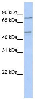WB Suggested Anti-ZNF491 Antibody Titration: 0.2-1 ug/ml; ELISA Titer: 1: 62500; Positive Control: MCF7 cell lysate