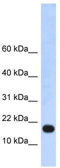 WB Suggested Anti-LOC115648 Antibody Titration: 0.2-1 ug/ml; ELISA Titer: 1:312500; Positive Control: Human heart