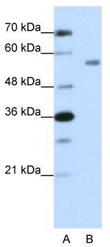 WB Suggested Anti-ZNF497 Antibody Titration: 1.25 ug/ml; Positive Control: HepG2 cell lysate