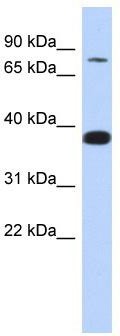 WB Suggested Anti-ZNF526 Antibody Titration: 0.2-1 ug/ml; ELISA Titer: 1:12500; Positive Control: MCF7 cell lysate
