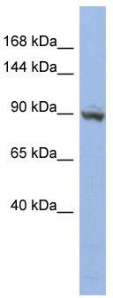 WB Suggested Anti-ZNF546 Antibody Titration: 0.2-1 ug/ml; ELISA Titer: 1:1562500; Positive Control: HT1080 cell lysate