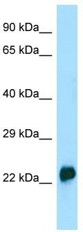 WB Suggested Anti-CRYGA Antibody; Titration: 1.0 ug/ml; Positive Control: HCT15 Whole Cell