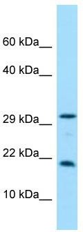 WB Suggested Anti-CRYGN Antibody; Titration: 1.0 ug/ml; Positive Control: Hela Whole cell