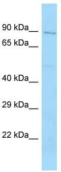 Host: Rabbit; Target Name: RAP1GAP2; Sample Tissue: HCT15 Whole Cell lysates; Antibody Dilution: 1.0 ug/mlRAP1GAP2 is supported by BioGPS gene expression data to be expressed in HCT15