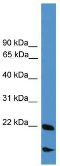 WB Suggested Anti-RBM18 Antibody Titration: 0.2-1 ug/ml; ELISA Titer: 1: 312500; Positive Control: COLO205 cell lysate