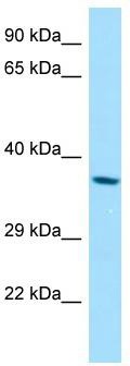 WB Suggested Anti-RDH8 Antibody; Titration: 1.0 ug/ml; Positive Control: A549 Whole Cell