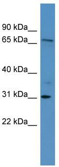 WB Suggested Anti-RGL3 Antibody Titration: 0.2-1 ug/ml; ELISA Titer: 1:62500; Positive Control: HepG2 cell lysate