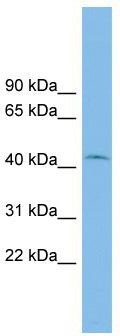 WB Suggested Anti-RIBC1 Antibody Titration: 0.2-1 ug/ml; ELISA Titer: 1: 62500; Positive Control: COLO205 cell lysate